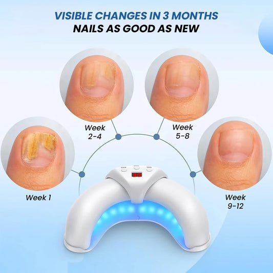 Zero Fungus Multi-Nail LED Anti-Fungus Kit